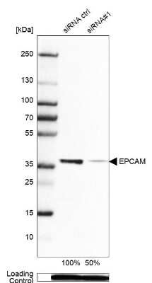 Western Blot: EpCAM/TROP1 Antibody (CL6259) [NBP2-76485]