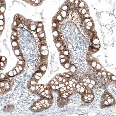 Immunohistochemistry-Paraffin: EpCAM/TROP1 Antibody (CL6313) [NBP2-76486]