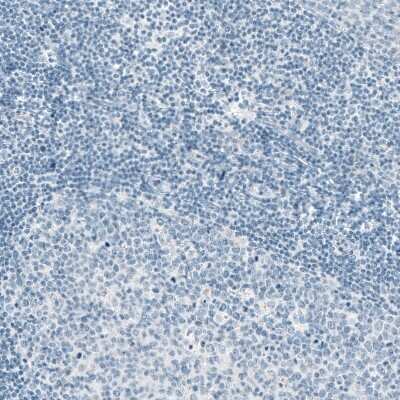 Immunohistochemistry-Paraffin: EpCAM/TROP1 Antibody (CL6313) [NBP2-76486]