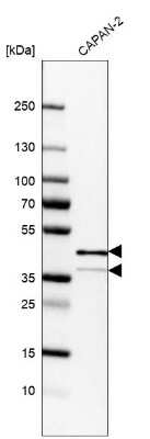 Western Blot: EpCAM/TROP1 Antibody (CL6313) [NBP2-76486]