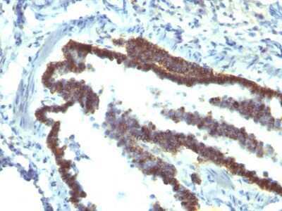 Immunohistochemistry-Paraffin: EpCAM/TROP1 Antibody (EGP40/1110) - (ECD) - Azide and BSA Free [NBP2-47873]