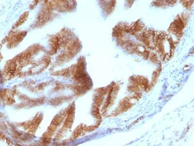 Immunohistochemistry-Paraffin: EpCAM/TROP1 Antibody (EGP40/1110) - (ECD) - Azide and BSA Free [NBP2-47873]
