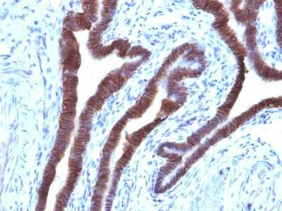 Immunohistochemistry-Paraffin: EpCAM/TROP1 Antibody (EGP40/1110) - (ECD) - Azide and BSA Free [NBP2-47873]