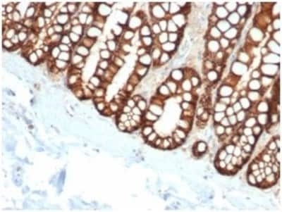 Immunohistochemistry-Paraffin: EpCAM/TROP1 Antibody (EGP40/1110) - (ECD) - Azide and BSA Free [NBP2-47873]