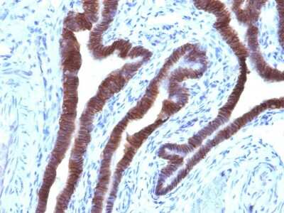 Immunohistochemistry-Paraffin: EpCAM/TROP1 Antibody (EGP40/1110) - (ECD) - IHC-Prediluted [NBP2-48264]