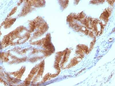 Immunohistochemistry-Paraffin: EpCAM/TROP1 Antibody (EGP40/1110) - (ECD) - IHC-Prediluted [NBP2-48264]