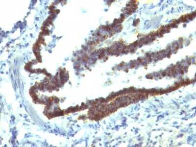 Immunohistochemistry-Paraffin: EpCAM/TROP1 Antibody (EGP40/1110) - (ECD) - IHC-Prediluted [NBP2-48264]
