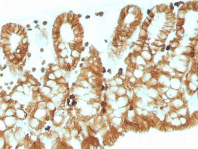 Immunohistochemistry-Paraffin: EpCAM/TROP1 Antibody (EGP40/1110) - (ECD) - IHC-Prediluted [NBP2-48264]