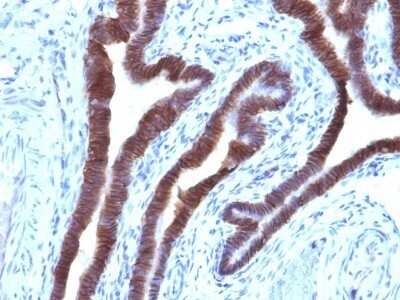 Immunohistochemistry-Paraffin: EpCAM/TROP1 Antibody (EGP40/1110) - (ECD) [NBP2-44635]