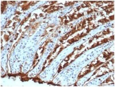 Immunohistochemistry-Paraffin: EpCAM/TROP1 Antibody (EGP40/1110) - (ECD) [NBP2-44635]