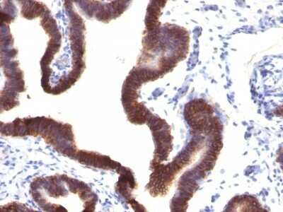 Immunohistochemistry-Paraffin: EpCAM/TROP1 Antibody (EGP40/1120) - (ECD) - Azide and BSA Free [NBP2-47874]