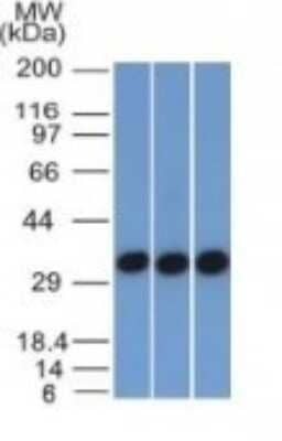 Western Blot: EpCAM/TROP1 Antibody (EGP40/1372)(ECD)Azide and BSA Free [NBP2-54419]