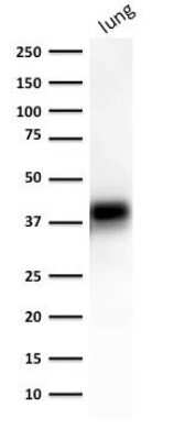 Western Blot: EpCAM/TROP1 Antibody (EGP40/1372)(ECD)Azide and BSA Free [NBP2-54419]