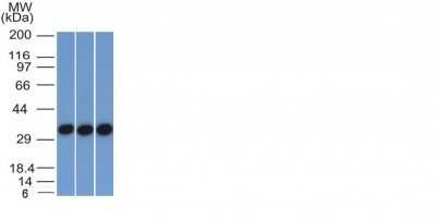 Western Blot: EpCAM/TROP1 Antibody (EGP40/1372)(ECD) [NBP2-53264]