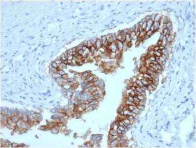 Immunohistochemistry-Paraffin: EpCAM/TROP1 Antibody (EGP40/1373) - (ECD) - Azide and BSA Free [NBP2-54348]