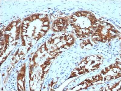 Immunohistochemistry-Paraffin: EpCAM/TROP1 Antibody (EGP40/1373) - (ECD) - Azide and BSA Free [NBP2-54348]