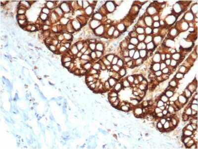 Immunohistochemistry-Paraffin: EpCAM/TROP1 Antibody (EGP40/1373) - (ECD) - Azide and BSA Free [NBP2-54348]