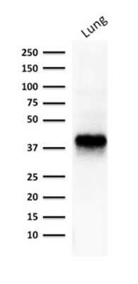 Western Blot: EpCAM/TROP1 Antibody (EGP40/1373)(ECD)Azide and BSA Free [NBP2-54348]