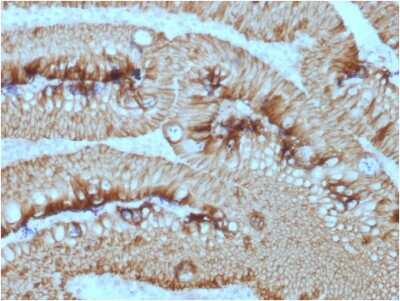 Immunohistochemistry-Paraffin: EpCAM/TROP1 Antibody (EGP40/1373) - (ECD) [NBP2-53277]