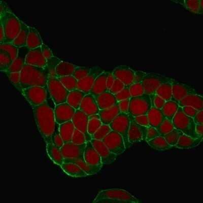 Immunocytochemistry/ Immunofluorescence: EpCAM/TROP1 Antibody (EGP40/1384) - (ECD) - Azide and BSA Free [NBP2-54333]