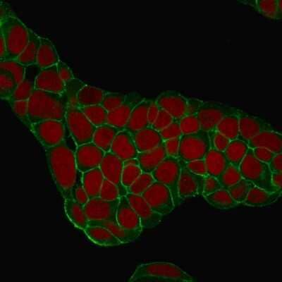 Immunocytochemistry/ Immunofluorescence: EpCAM/TROP1 Antibody (EGP40/1384) - (ECD) [NBP2-53159]