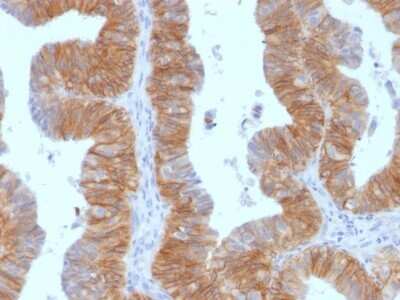 Immunohistochemistry-Paraffin: EpCAM/TROP1 Antibody (EGP40/1384) - (ECD) [NBP2-53159]