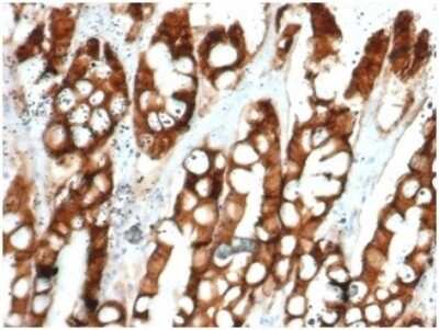 Immunohistochemistry-Paraffin: EpCAM/TROP1 Antibody (EGP40/1384) - (ECD) [NBP2-53159]