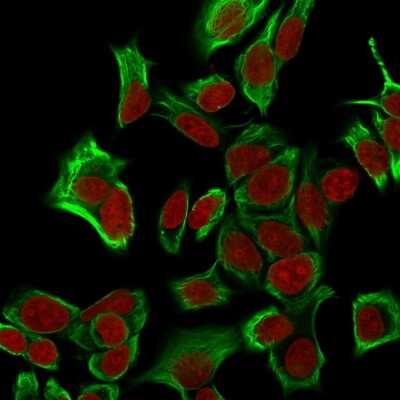 Immunocytochemistry/ Immunofluorescence: EpCAM/TROP1 Antibody (EGP40/1555R) - (ECD) - Azide and BSA Free [NBP2-54424]