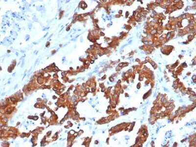 Immunohistochemistry-Paraffin: EpCAM/TROP1 Antibody (EGP40/1555R) - (ECD) - Azide and BSA Free [NBP2-54424]