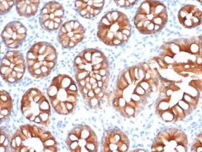 Immunohistochemistry-Paraffin: EpCAM/TROP1 Antibody (EGP40/1555R) - (ECD) - Azide and BSA Free [NBP2-54424]