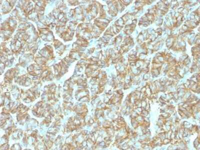 Immunohistochemistry-Paraffin: EpCAM/TROP1 Antibody (EGP40/1555R) - (ECD) [NBP2-53370]
