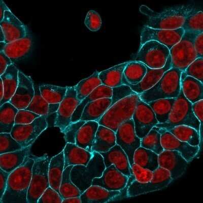 Immunocytochemistry/ Immunofluorescence: EpCAM/TROP1 Antibody (EGP40/1556R) - (ECD) - Azide and BSA Free [NBP2-54425]