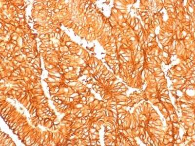 Immunohistochemistry-Paraffin: EpCAM/TROP1 Antibody (EGP40/1556R) - (ECD) - Azide and BSA Free [NBP2-54425]