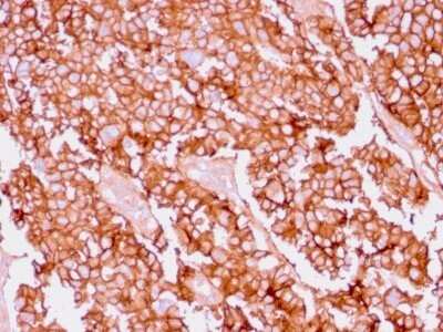 Immunohistochemistry-Paraffin: EpCAM/TROP1 Antibody (EGP40/1556R) - (ECD) - Azide and BSA Free [NBP2-54425]