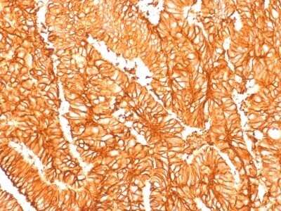 Immunohistochemistry-Paraffin: EpCAM/TROP1 Antibody (EGP40/1556R) - (ECD) [NBP2-53266]