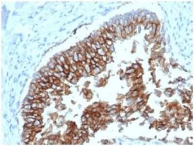 Immunohistochemistry-Paraffin: EpCAM/TROP1 Antibody (EGP40/1798) - (ECD) - Azide and BSA Free [NBP2-54456]