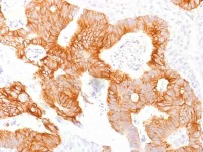 Immunohistochemistry-Paraffin: EpCAM/TROP1 Antibody (EGP40/1798) - (ECD) [NBP2-53213]