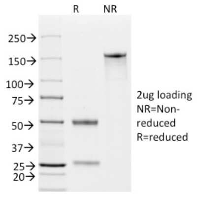 Western Blot: EpCAM/TROP1 Antibody (EGP40/826)Azide and BSA Free [NBP2-47876]