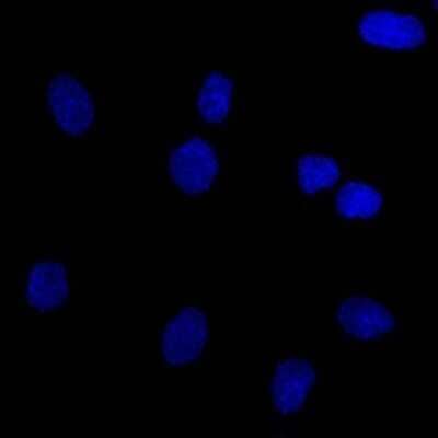 Immunocytochemistry/ Immunofluorescence: EpCAM/TROP1 Antibody (EGP40/826) - IHC-Prediluted [NBP2-48288]