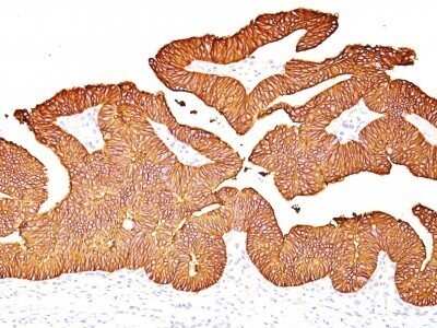 Immunohistochemistry-Paraffin: EpCAM/TROP1 Antibody (EGP40/837) - (ECD) - Azide and BSA Free [NBP2-47877]