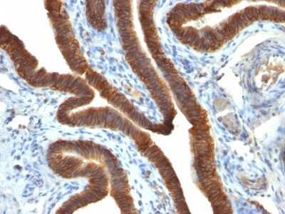Immunohistochemistry-Paraffin: EpCAM/TROP1 Antibody (EGP40/837) - (ECD) [NBP2-44644]