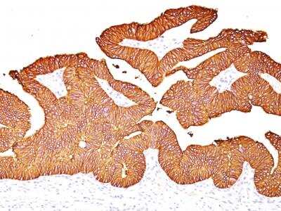 Immunohistochemistry-Paraffin: EpCAM/TROP1 Antibody (EGP40/837) - (ECD) - IHC-Prediluted [NBP2-48289]
