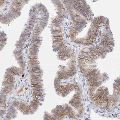 Immunohistochemistry-Paraffin: EpCAM/TROP1 Antibody [NBP1-89404]