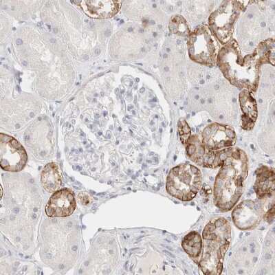 Immunohistochemistry-Paraffin: EpCAM/TROP1 Antibody [NBP1-89404]