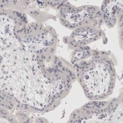 Immunohistochemistry-Paraffin: EpCAM/TROP1 Antibody [NBP1-89404]