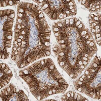 Immunohistochemistry-Paraffin: EpCAM/TROP1 Antibody [NBP1-89404]