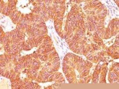 Immunohistochemistry-Paraffin: EpCAM/TROP1 Antibody [NBP2-27107]