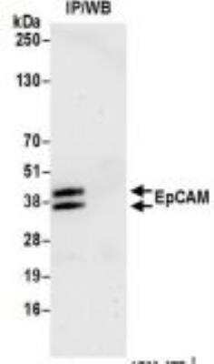 Immunoprecipitation: EpCAM/TROP1 Antibody (BLR077G) [NBP3-14685]