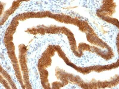 Immunohistochemistry-Paraffin: EpCAM/TROP1 Antibody (MOC-31) - Azide and BSA Free [NBP2-47875]