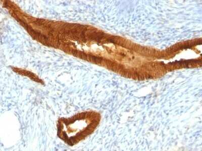 Immunohistochemistry-Paraffin: EpCAM/TROP1 Antibody (MOC-31) - Azide and BSA Free [NBP2-47875]